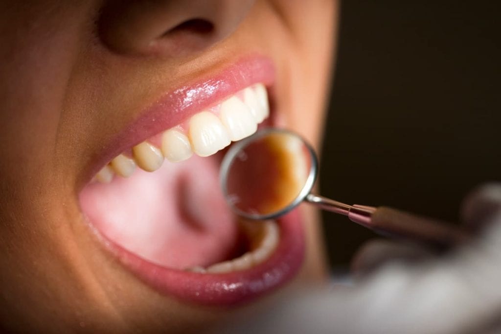 a woman opening her mouth for the mini magnifying glass