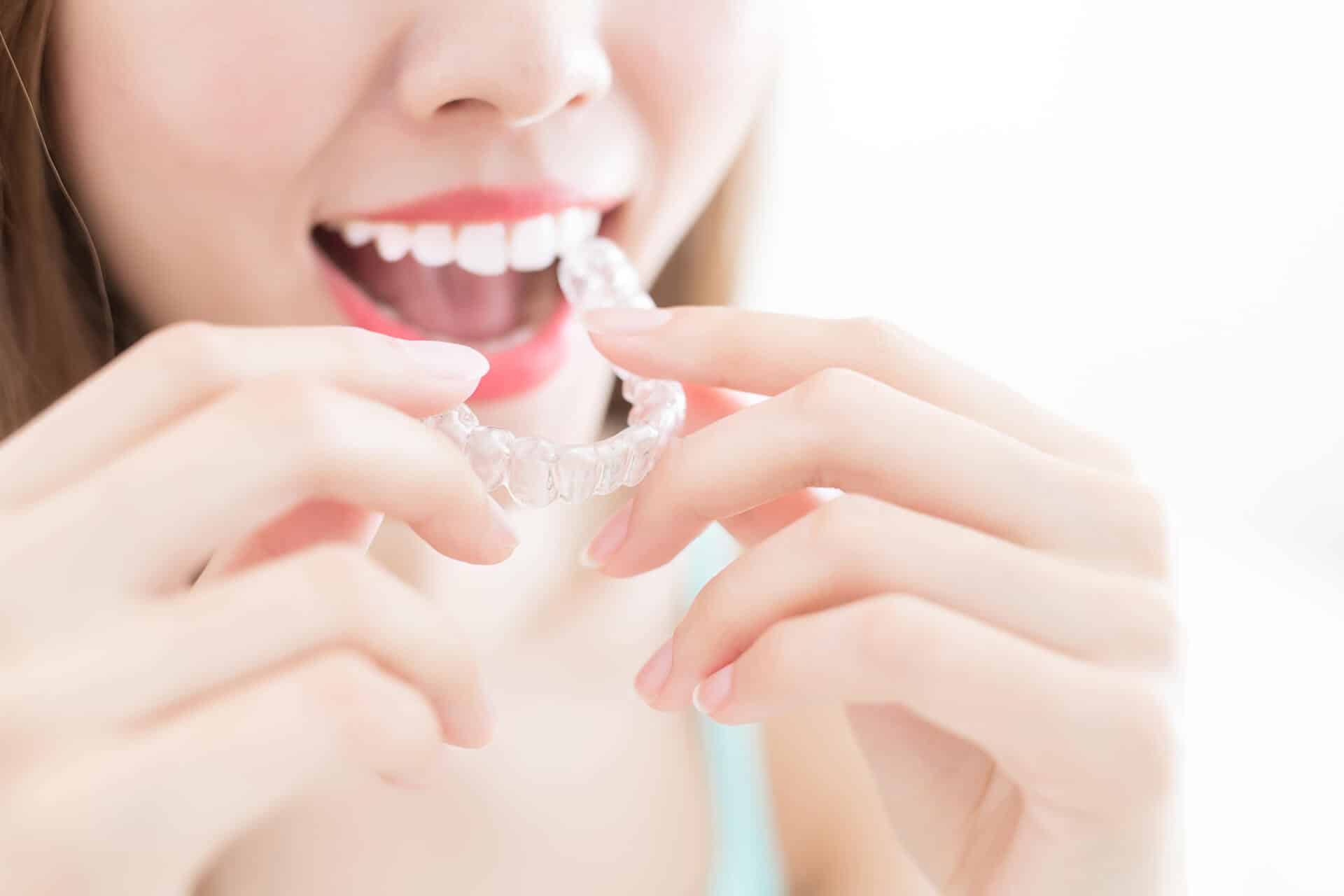 A woman putting on an invisible braces