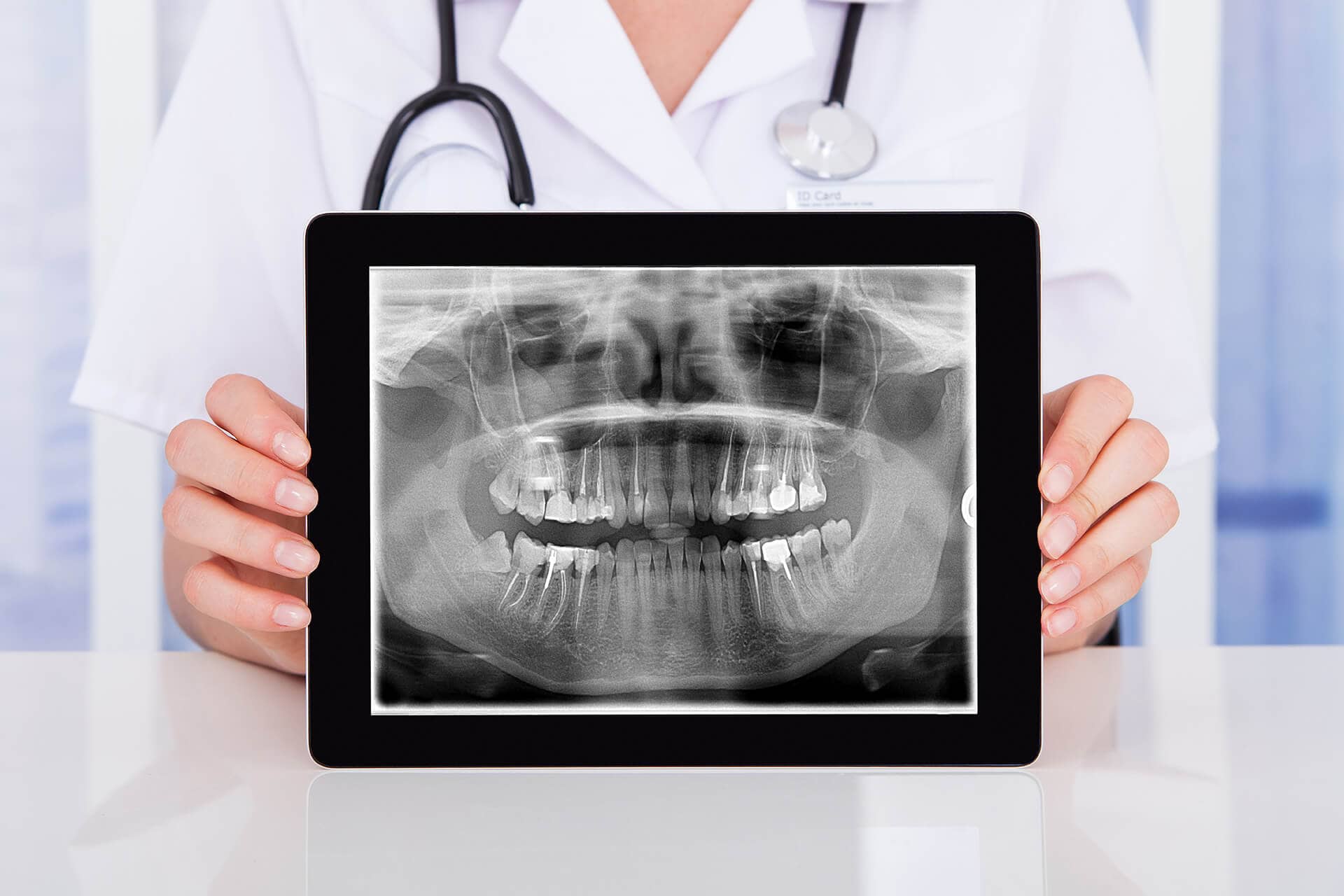 A dentist showing a Mouth Cavity X-ray