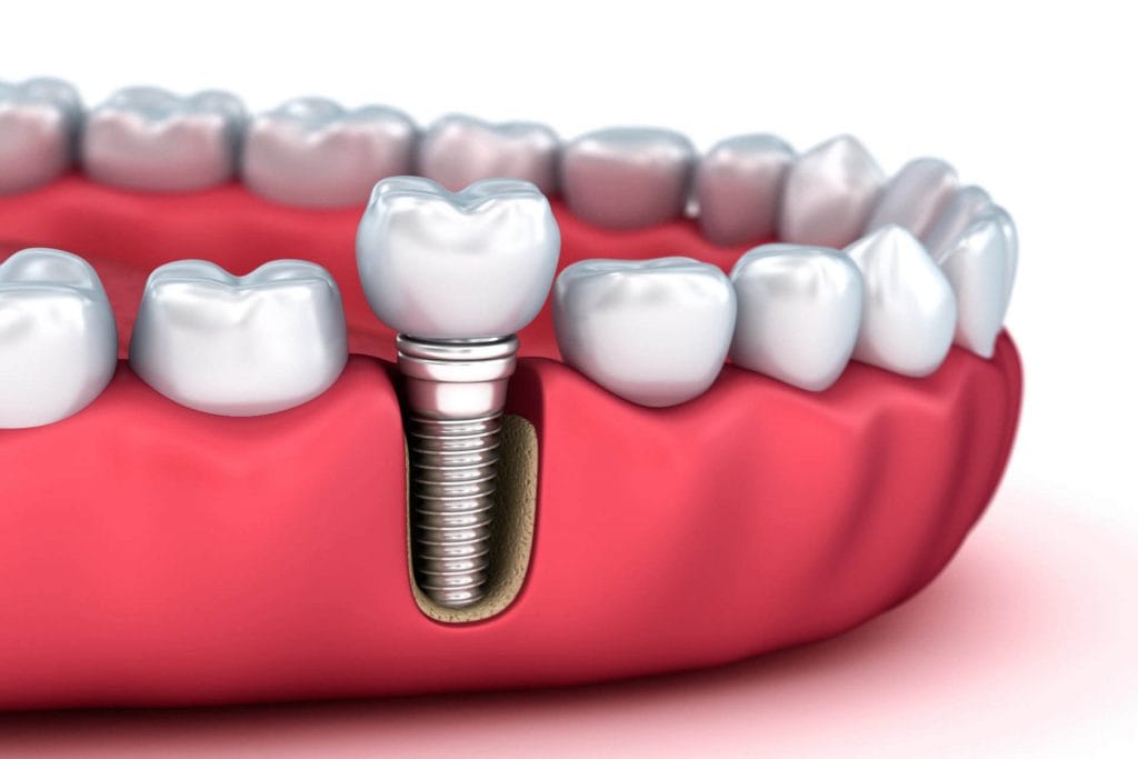 5 Types of Dentist and How They Can Help You 4