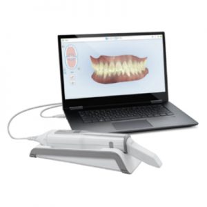 iTero-Scanner_t32dental