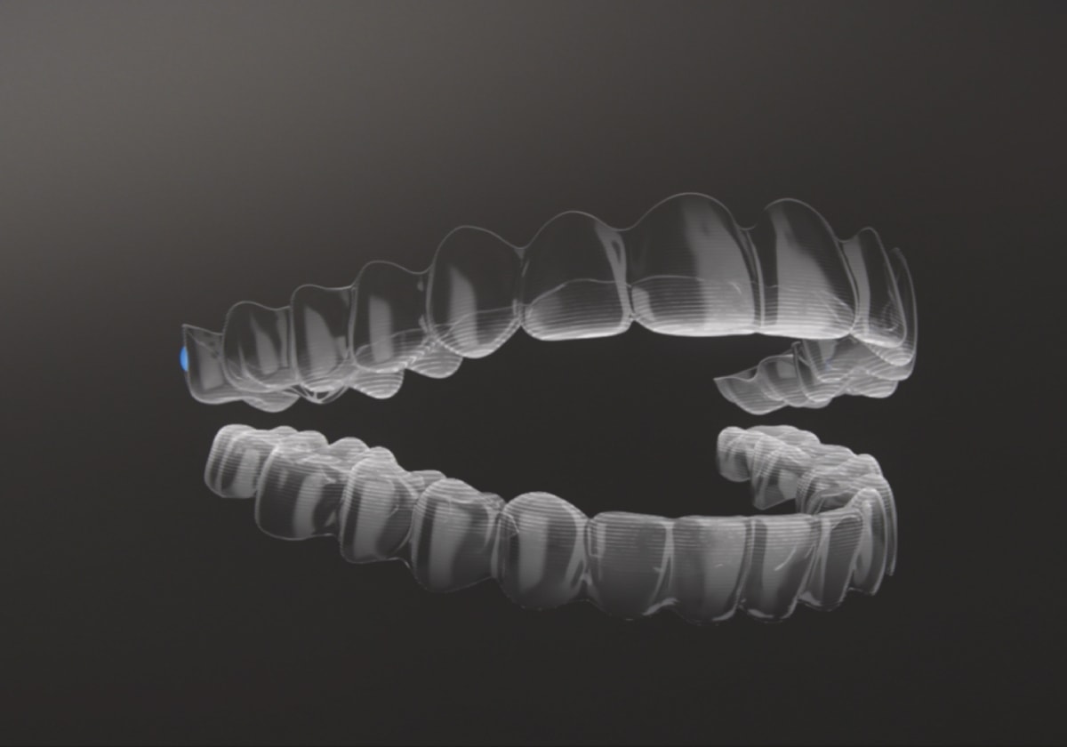 invisalign first_t32dental