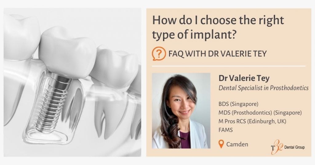 How do I choose the right type of implant - Dr Valerie Tey